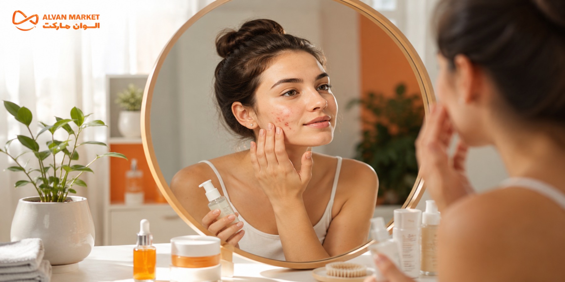 مقابله با جوش و آکنه؛ راهکارهای مؤثر و خانگی